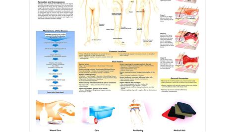 What Are The Stages Of A Decubitus Ulcers - Ulcer Choices