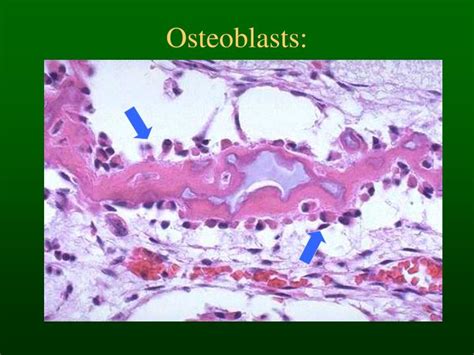 PPT - Bone Histology & Fracture Healing PowerPoint Presentation - ID:4589818