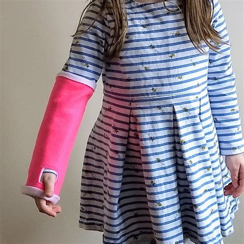 Fake arm cast First aid plaster cast broken arm | Etsy