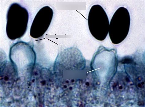 figure 9.9 coprinus, basidia with basidiospores Diagram | Quizlet