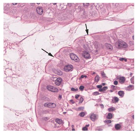 4.2 Epithelial Tissue – Anatomy and Physiology | Anatomy and physiology ...