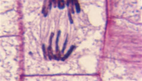 How to Identify Stages of Mitosis Within a Cell Under a Microscope | Sciencing