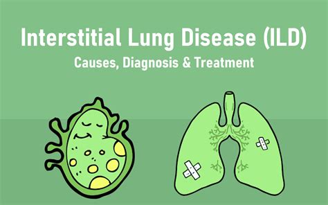 Interstitial Lung Disease – Causes, Diagnosis & Treatment