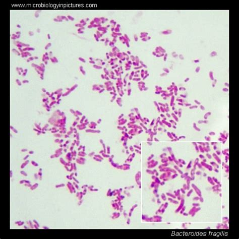 Bacteroides fragilis. Gram stain and cell morphology. Bacteroides ...