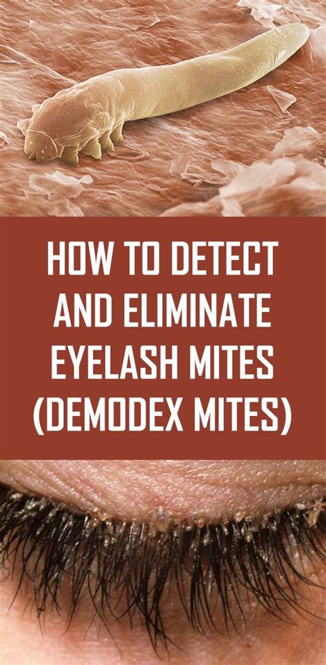 How to Detect and Eliminate Eyelash Mites (Demodex Mites) | Eyelash mites, Demodex mites, Demodex