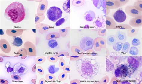 macrophage – eClinpath