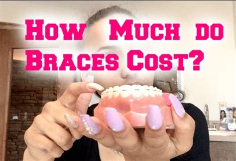 How Much Do Braces For Adults Cost? - North Durham Orthodontics