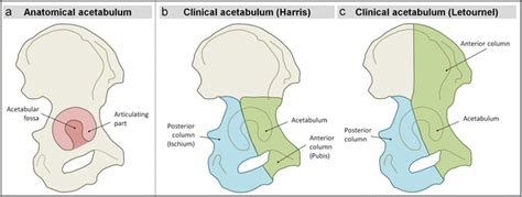 Anatomical definitions depicted on a right hemi pelvis, lateral view a... | Download Scientific ...