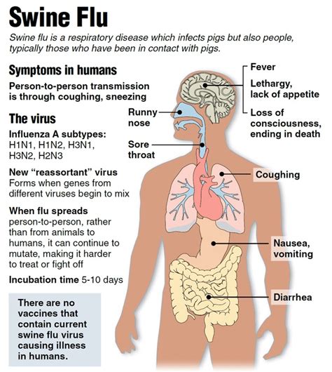 swine flu symptoms | Dr Lal PathLabs Blog