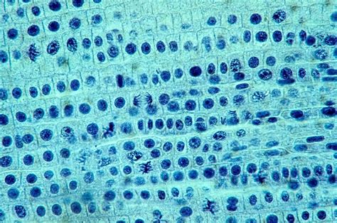 Onion Root Tip Mitosis / Biology 109 Lab Review for Practicum #1 - Onion root tip 2 - You have ...