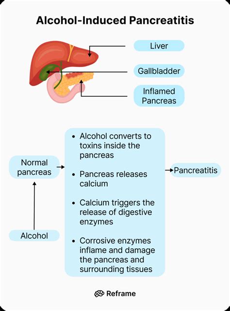 Alcohol and Pancreatitis: Learn the Risks | Reframe App