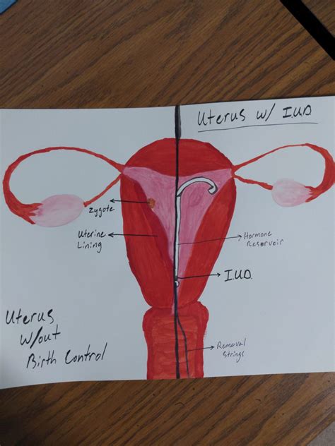 Hormonal Intrauterine Devices (IUD) Functionality and Mechanisms – Human STEAM