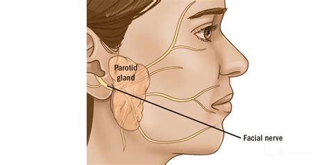 Parotidectomy (parotid tumor surgery): description, types of surgical ...