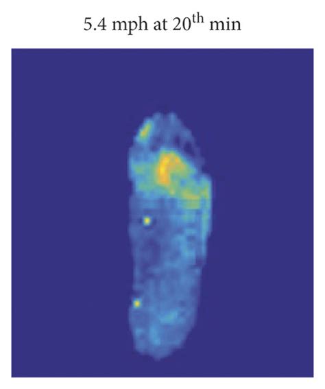 Examples of plantar pressure images after different walking speeds ...