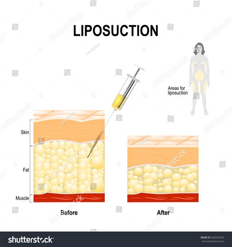 313 Skin Fats Lipids Images, Stock Photos & Vectors | Shutterstock