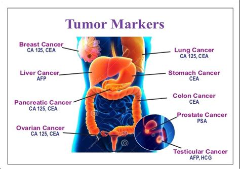 Tumor Markers