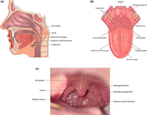 Human papillomavirus and oral and oropharyngeal carcinoma: the essentials - Yakin - 2019 ...