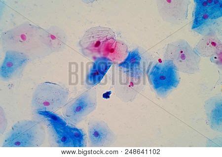 Squamous Epithelial Image & Photo (Free Trial) | Bigstock