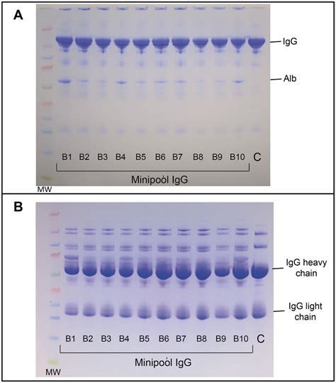 Sodium dodecyl sulfate-polyacrylamide gel electrophoresis. Patterns of ...