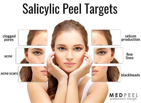 Salicylic Acid 20 Chemical Peel - Cosmetic Surgery Tips