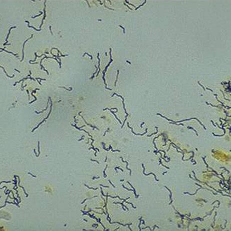 This dark field microscopy of the immune fluorescence staining ...