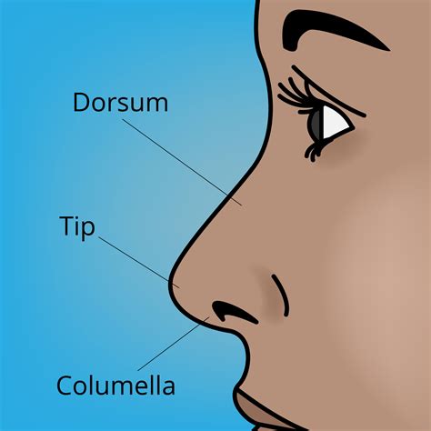 Open rhinoplasty