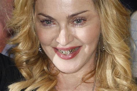 Madonna's dental art | Teeth care, Teeth health, Dental health