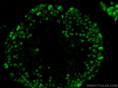 CREST antibody (12439-1-AP) | Proteintech | 武汉三鹰生物技术有限公司