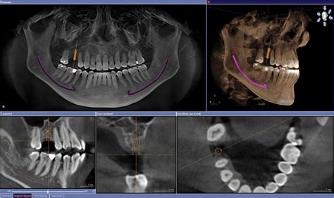 Houston, TX Dentist