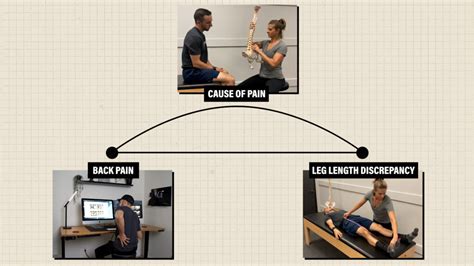 Leg Length Discrepancy - E3 Rehab