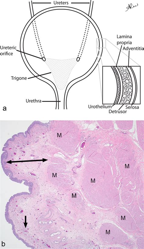 a Diagram of the bladder. Two ureters enter the bladder posteriorly to ...