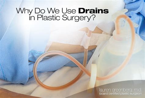 Types Of Drains After Surgery - Best Drain Photos Primagem.Org