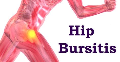 Bursitis | Causes, Symptoms, Treatment | Vitality Chiropractic Australia