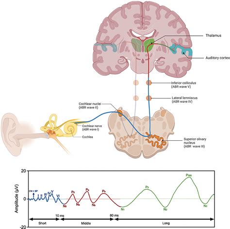 Frontiers | Brainstem evoked auditory potentials in tinnitus: A best-evidence synthesis and meta ...