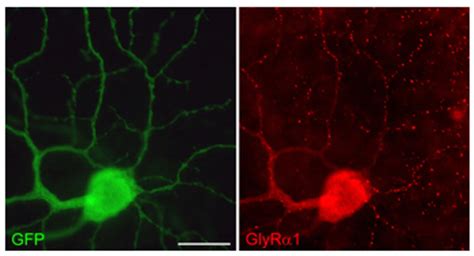 Glycine Receptor Diversity in the Mammalian Retina by Silke Haverkamp – Webvision