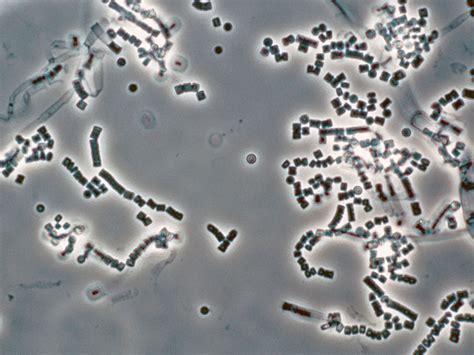 Geotrichum candidum ~ Everything You Need to Know with Photos | Videos