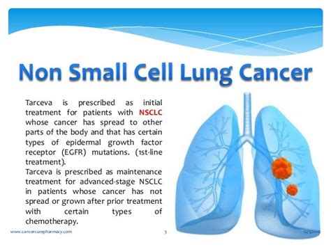 Tratamientos de cáncer de pulmón no de células pequeñas por etapa - Cáncer De Pulmón 2024