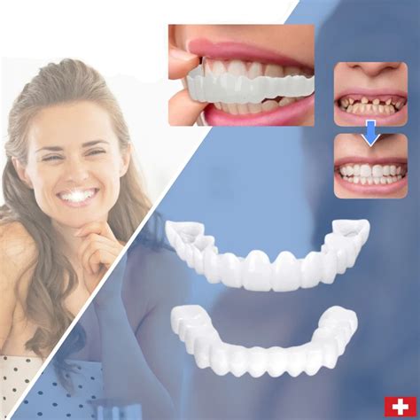 【LAST DAY SALE】Snap-on teeth™ - Always the perfect smile with these ve ...