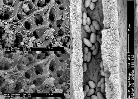 The control group displaying biofilm of E. faecalis in SEM views in the... | Download Scientific ...