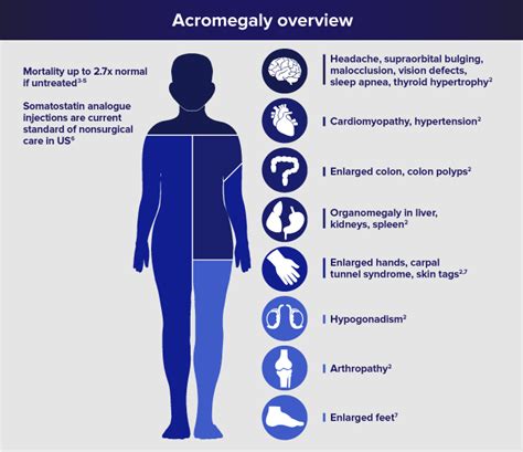 Ionis Pharmaceuticals And IONIS-GHR-LRx In Acromegaly - Ionis Pharmaceuticals, Inc. (NASDAQ:IONS ...