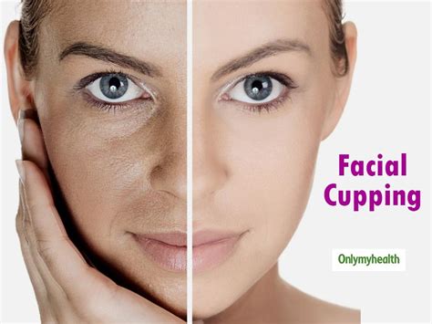 Facial Cupping: This Ancient Treatment Offers Amazing Skin Benefits ...