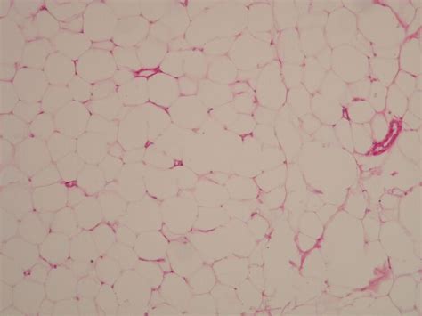 Adipose tissue (histology slide) - WikiLectures