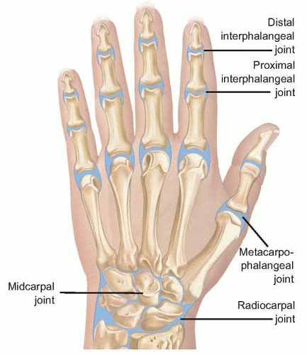 Surgical Treatment of Septic Arthritis in the Hand and Wrist | Musculoskeletal Key