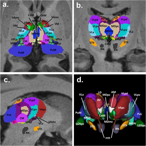 Segmentation of the thalamus and nuclei. Axial (a), coronal (b ...