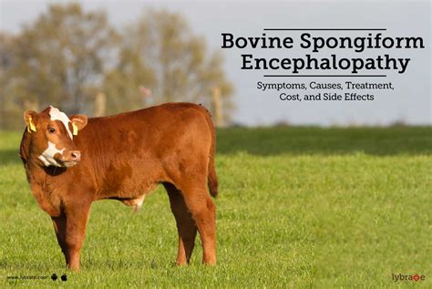 Bovine Spongiform Encephalopathy: Symptoms, Causes, Treatment, Cost ...