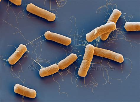 Bacteria and Fungus seen in the Scanning and Transmission Electron Microscope - scientific ...