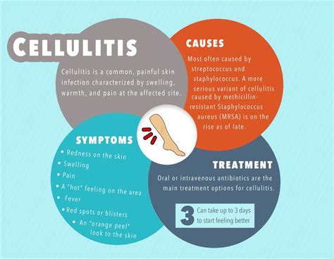 Cellulitis: Symptoms, Causes, Treatment, and Diagnosis | FindATopDoc