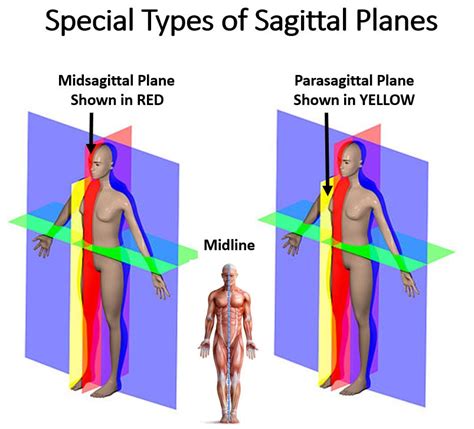 Parasagittal Plane Definition