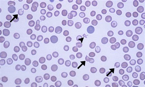 Keratocytes – Cells and Smears