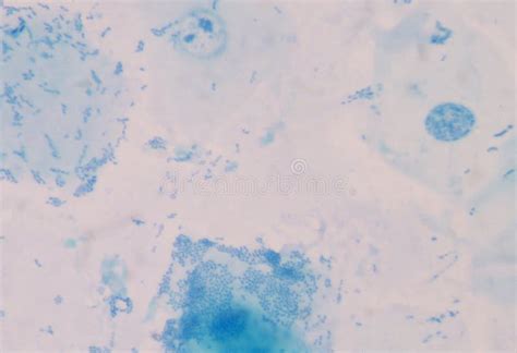 Blue bacteria stock photo. Image of bacteria, medicine - 2499968